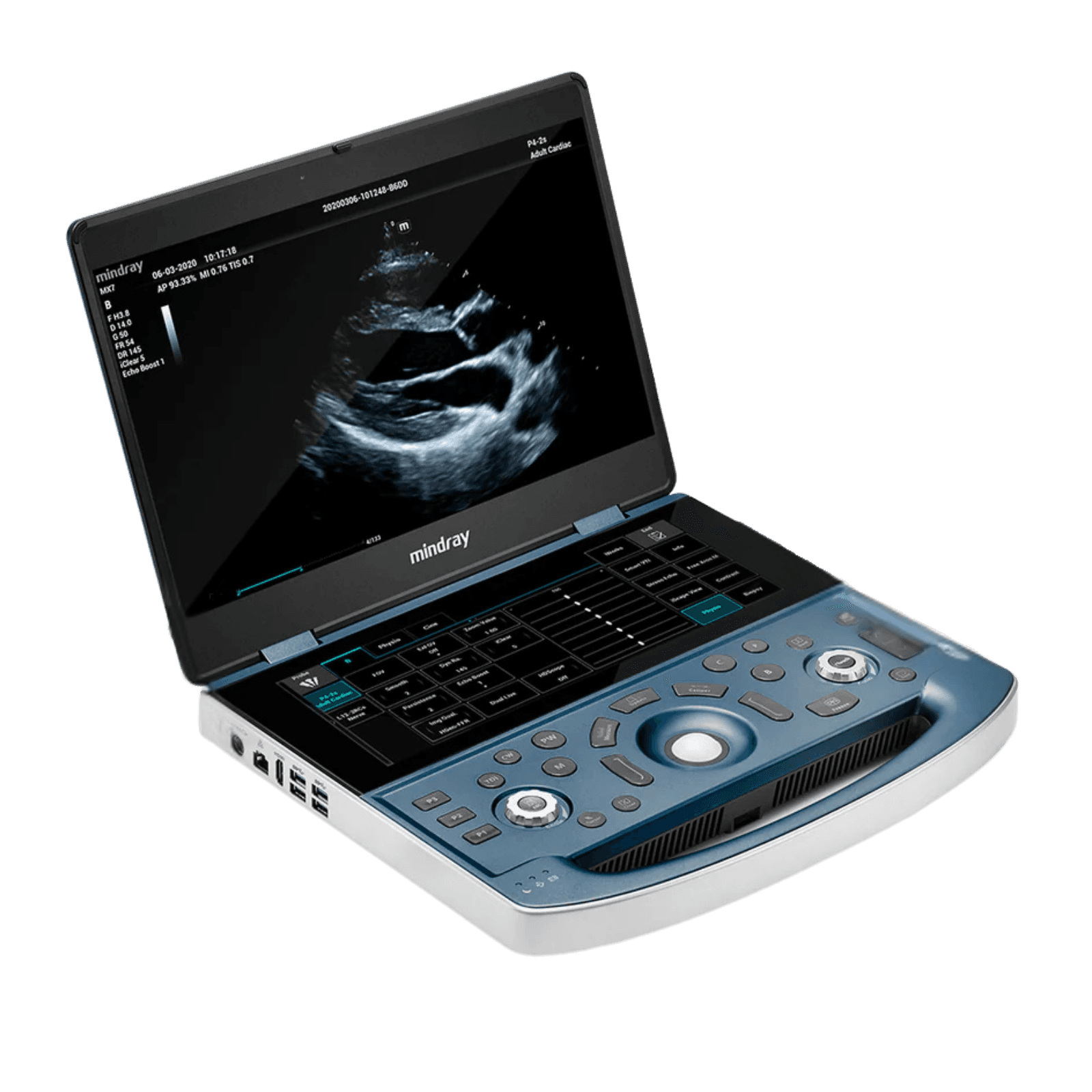 Mindray MX7