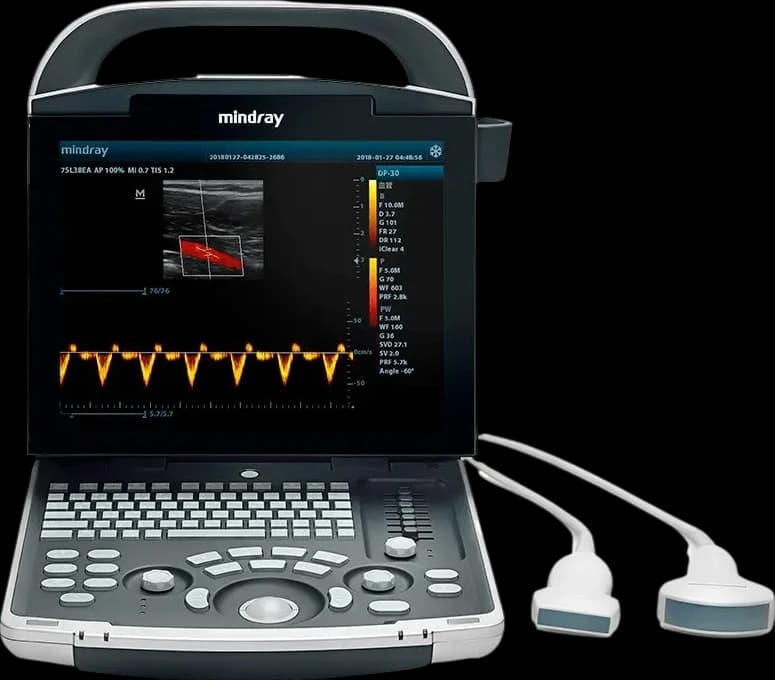 Mindray DP-30