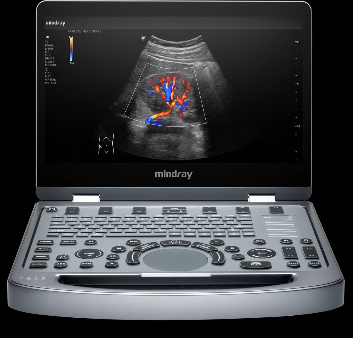 Mindray MX3