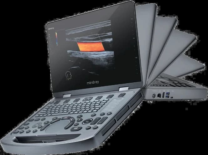 Mindray MX6