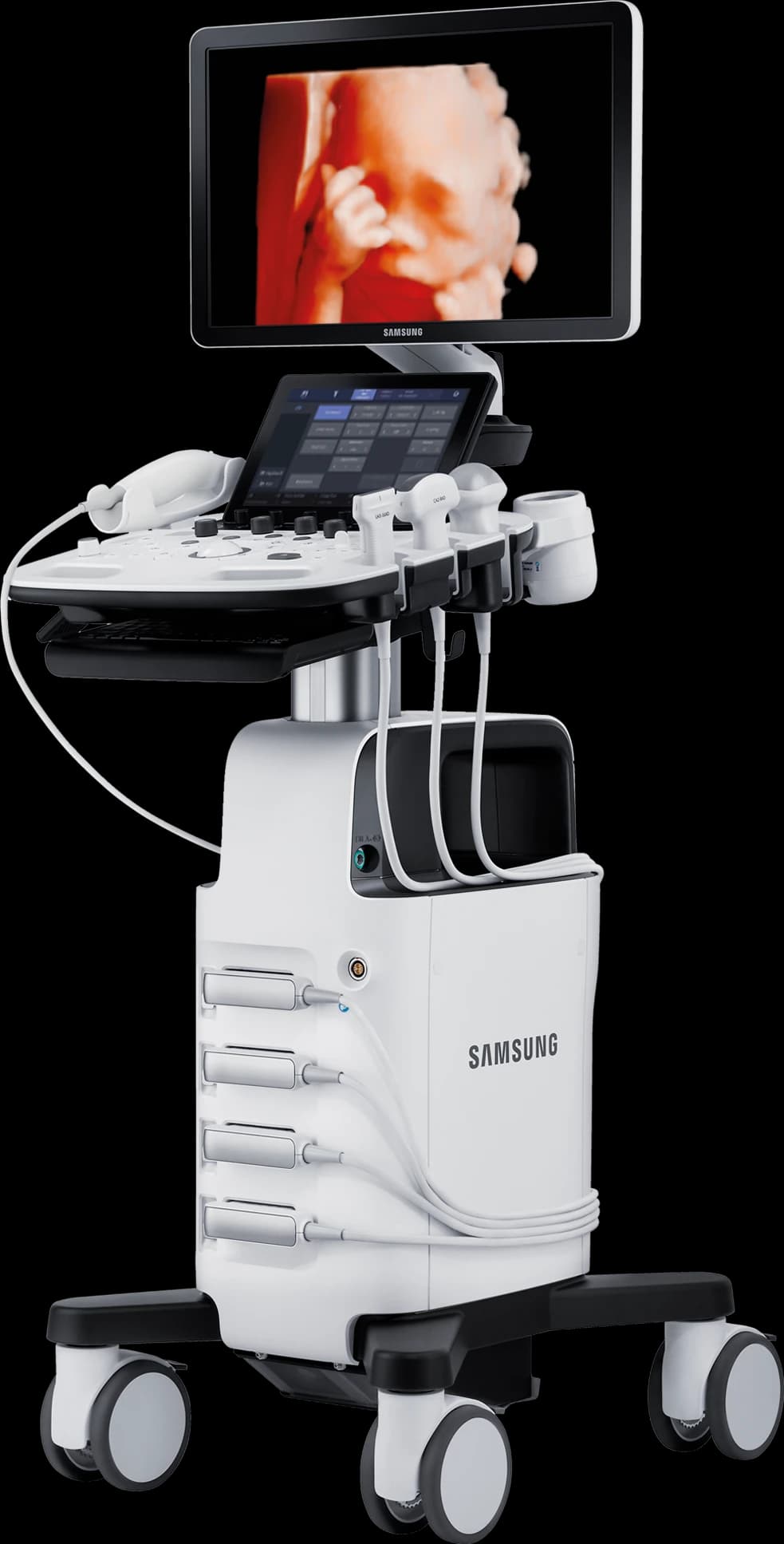 Ultrasonido Samsung HS40