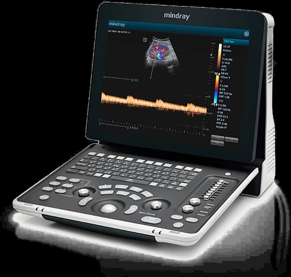 Mindray Z60