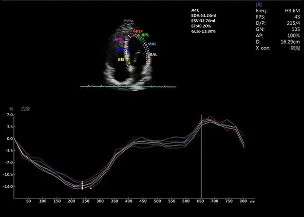 Strain y strain rate