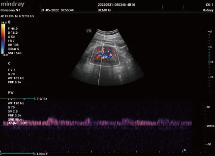 PW renal