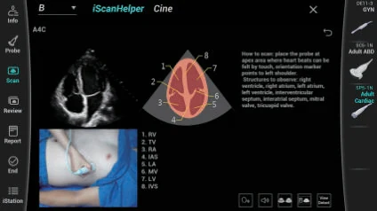 Herramienta de aprendizaje iScanHelper en el Consona N7