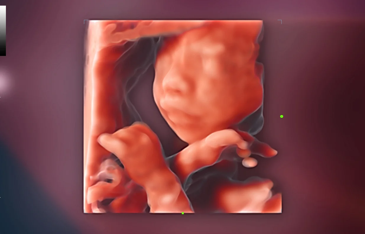 Cara fetal con iLive+