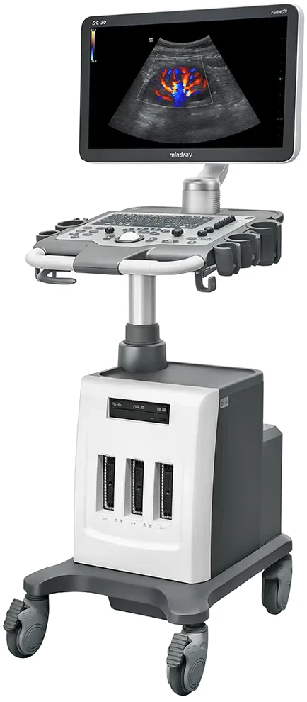 Mindray DC-30 en tres cuartos con estudio Doppler renal en pantalla
