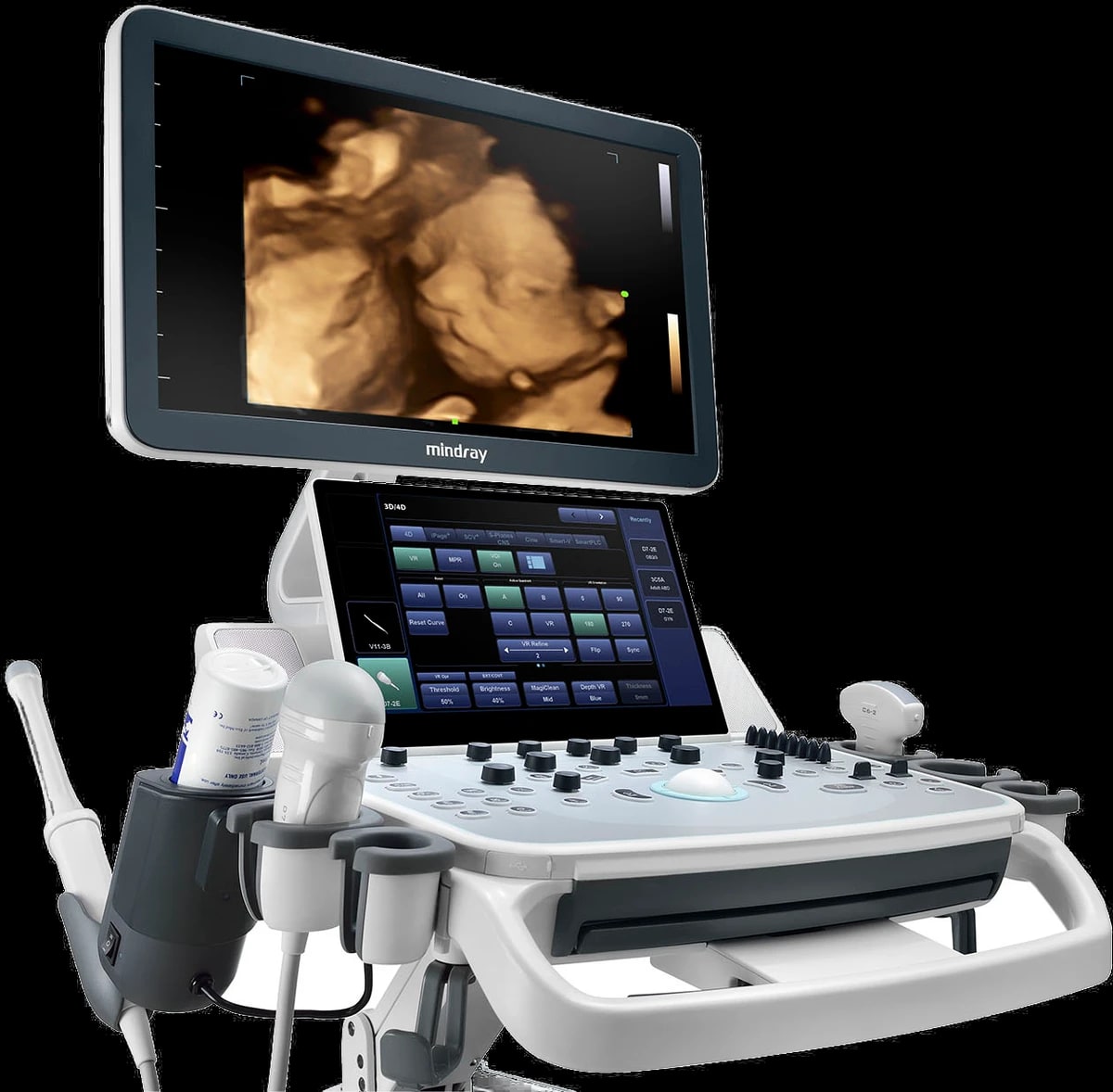 Mindray DC-40 en tres cuartos con imagen fetal 4D en pantalla