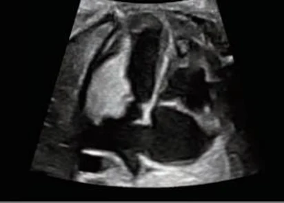 Corazón fetal