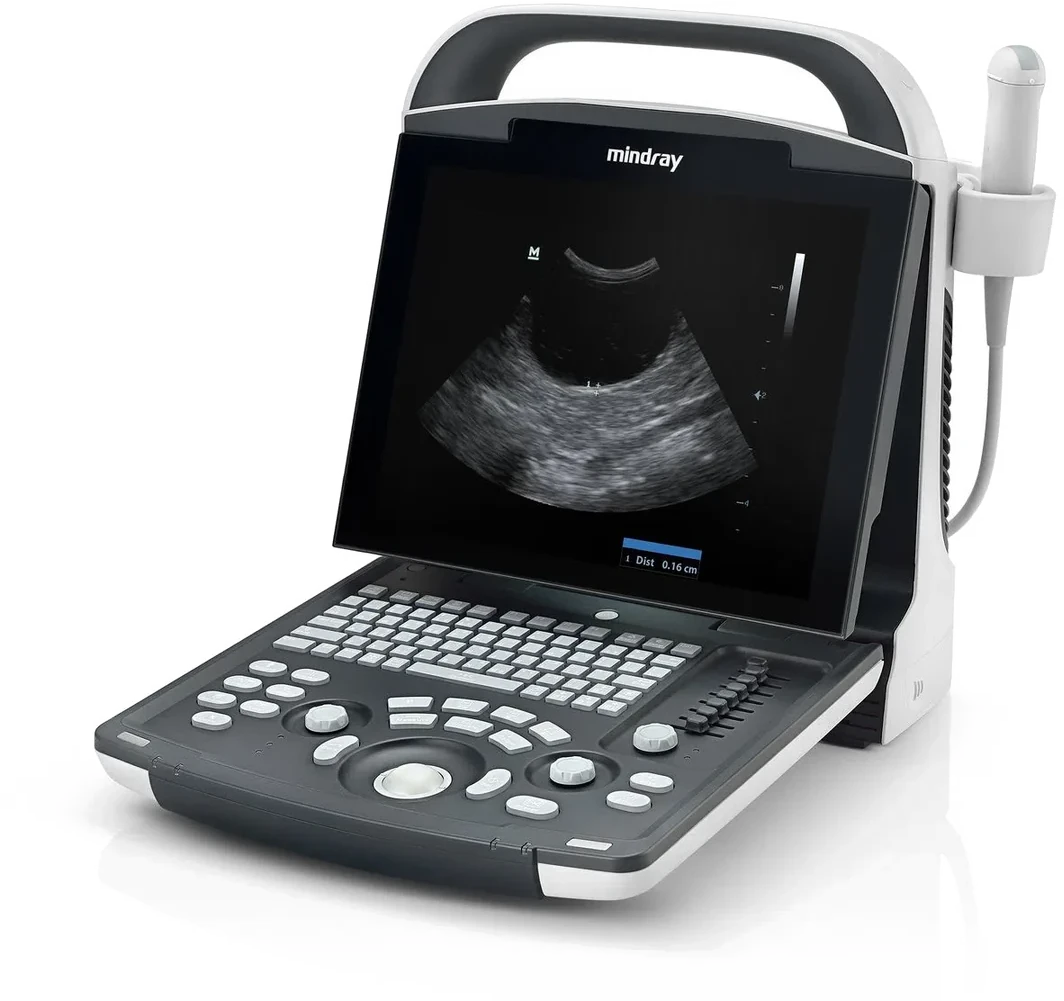 Mindray DP-10 abierto con un estudio abdominal en pantalla