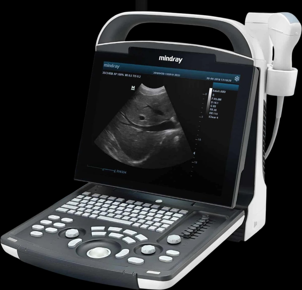 Mindray DP-20 en tres cuartos con un estudio Doppler en pantalla