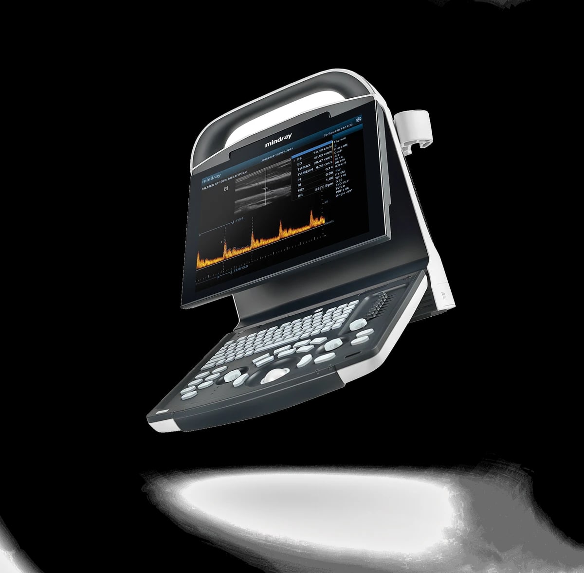 Mindray DP-20 con imagen abdominal en pantalla
