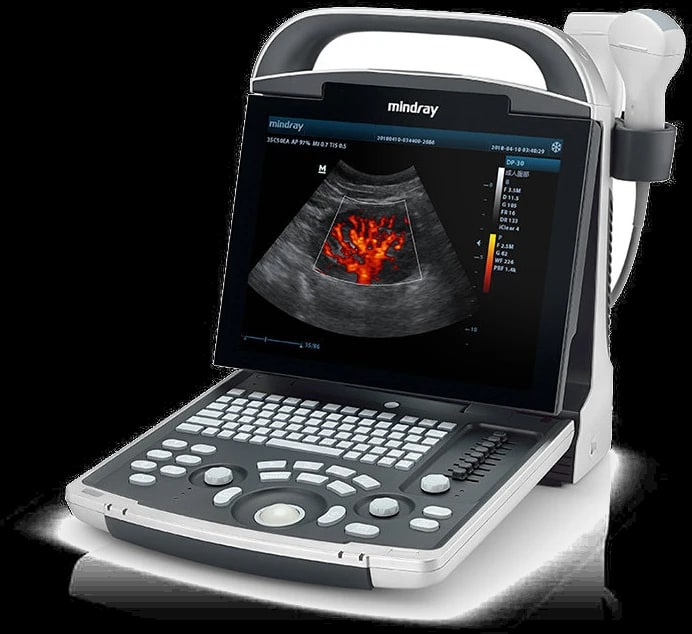 Mindray DP-30 en tres cuartos con el transductor en su soporte