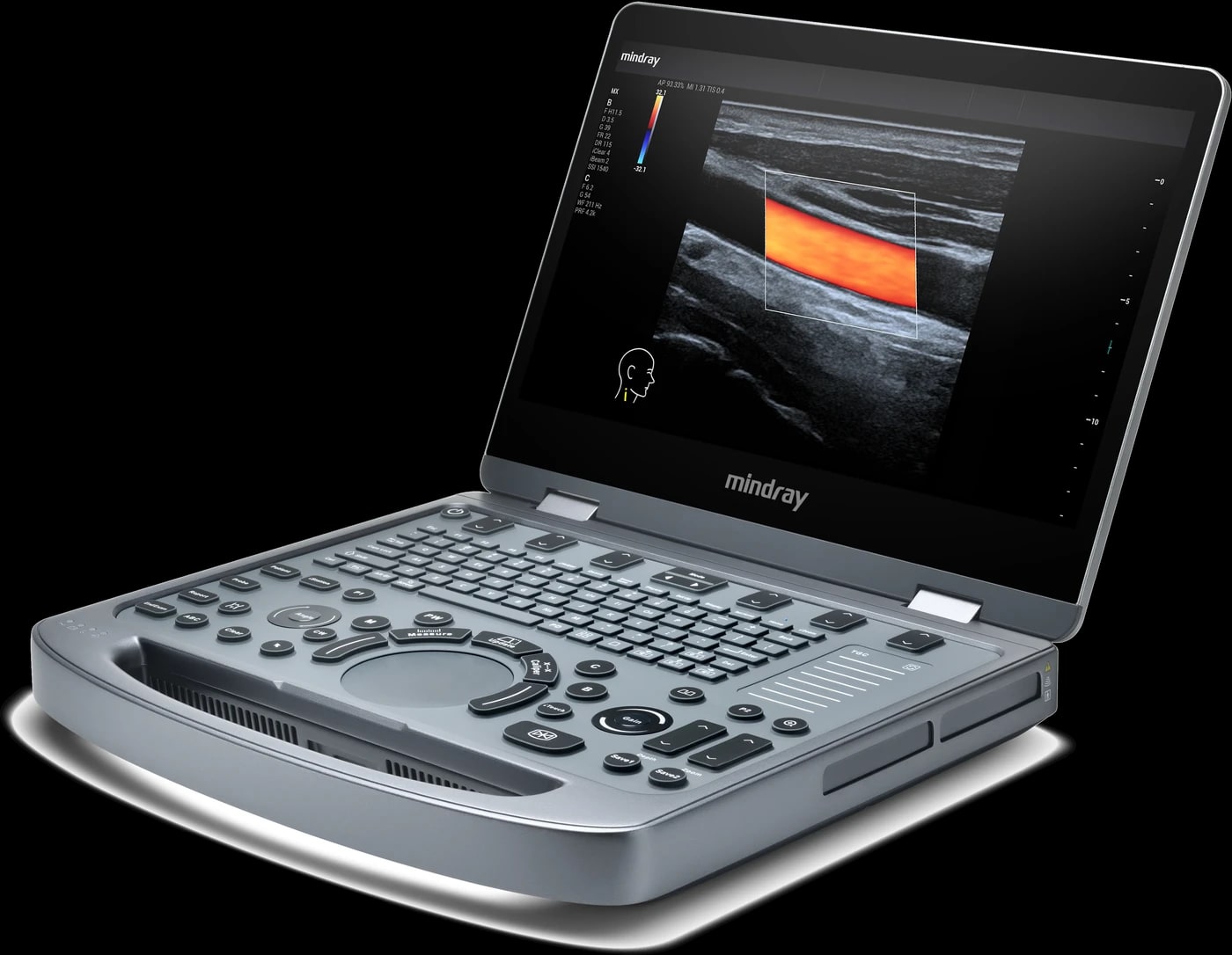 Mindray MX3 con imagen Doppler color en pantalla