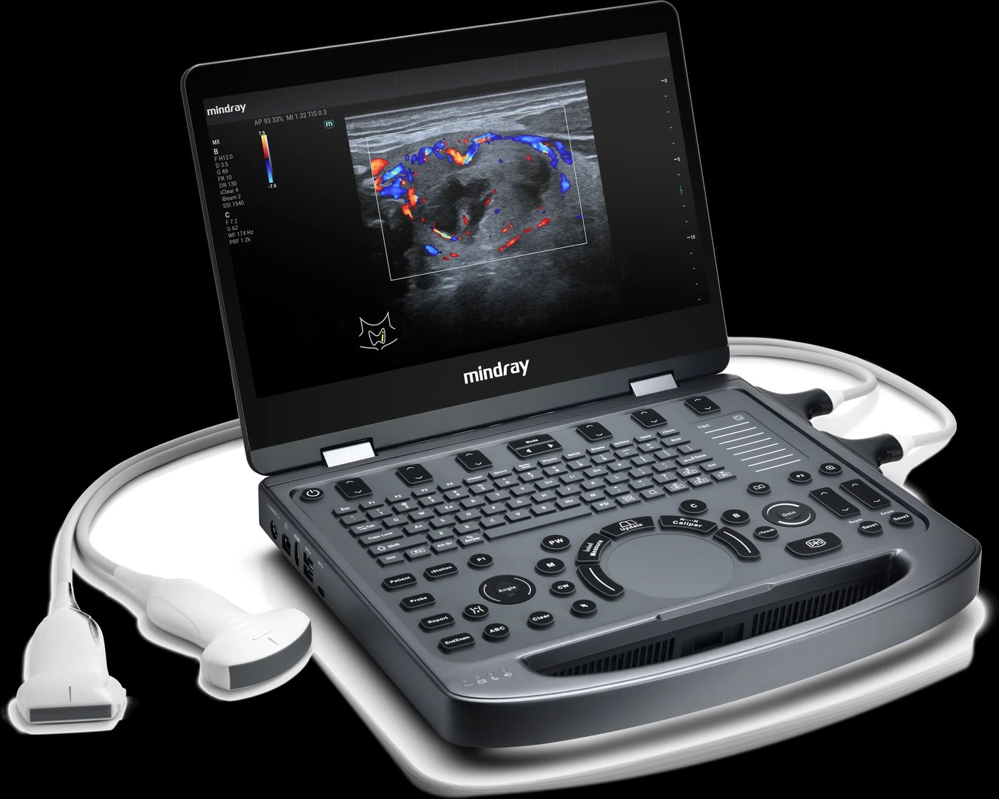 Mindray MX3 con varios transductores conectados