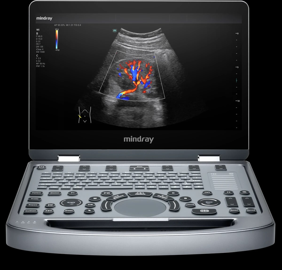 Mindray MX3