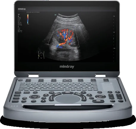 Mindray MX6 con imagen Doppler color en pantalla