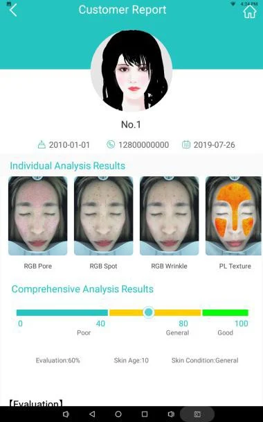Informe de cliente del Nubway Skin Analyzer con los resultados de poros, manchas, arrugas y textura