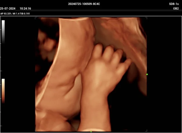 Cara fetal en 3D