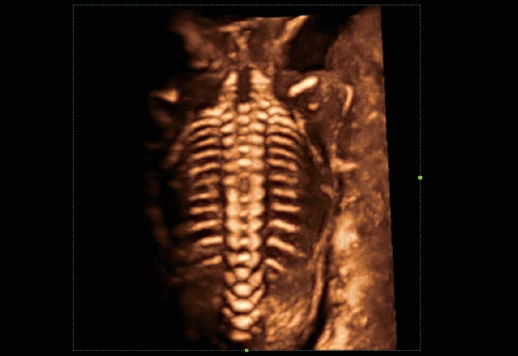 Columna fetal en 3D
