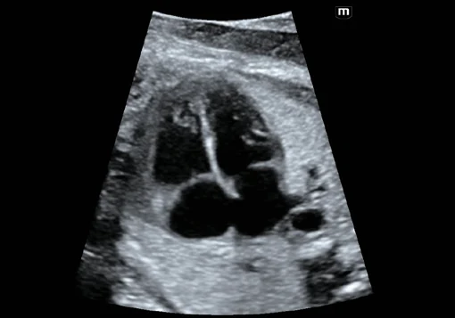 Corazón fetal