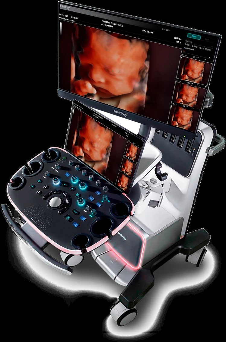 Mindray Nuewa i9, vista del equipo
