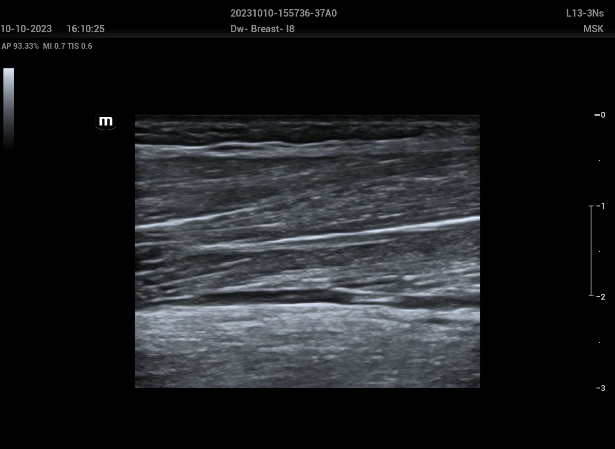 Estudio musculoesquelético