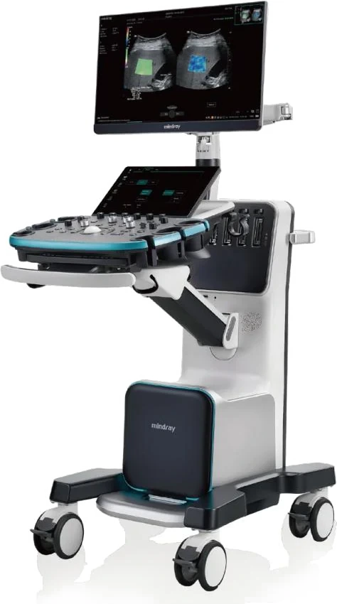 Mindray Resona i8 con un estudio abdominal en el monitor de 23,8 pulgadas
