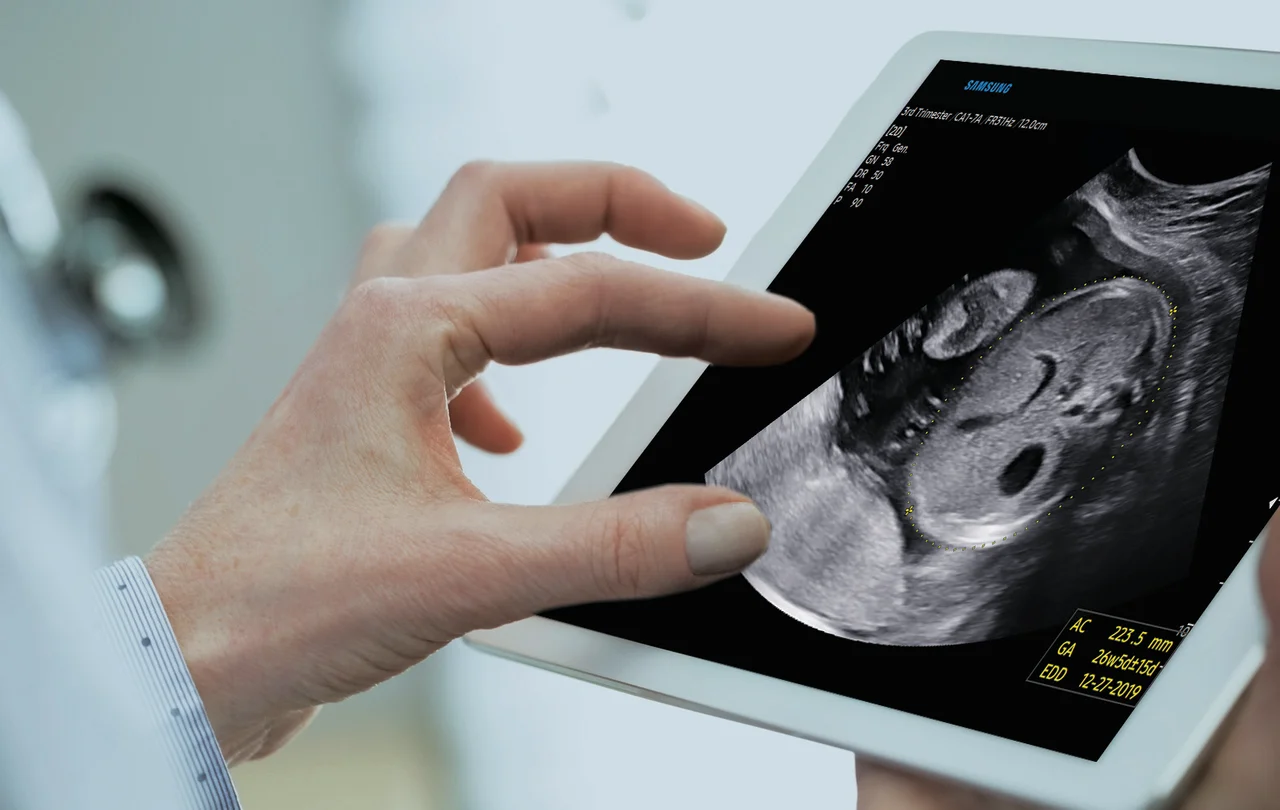Imagen del Samsung Hera W10 compartida en una tableta con SonoSync