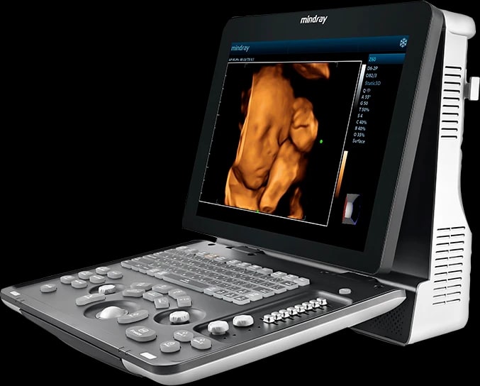 Mindray Z60 en tres cuartos con imagen fetal 3D en pantalla