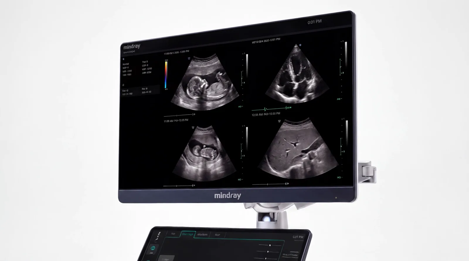 Monitor sin bisel de 23,8 pulgadas del Mindray Resona i9