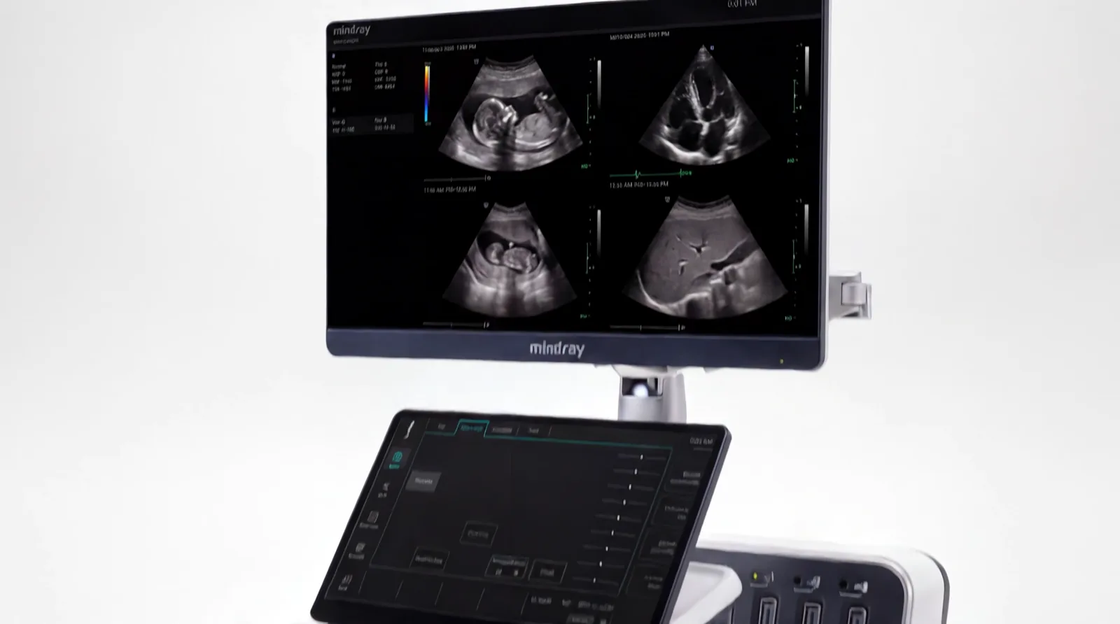 Panel táctil full-HD de 15,6 pulgadas del Resona i9