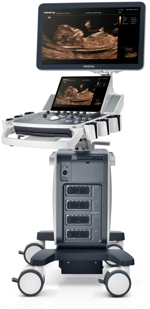 Mindray DC-70 X-Insight