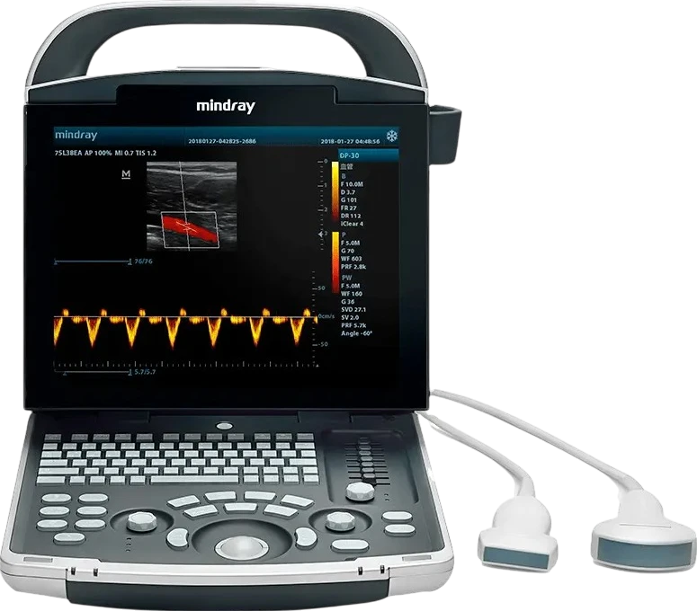 Mindray DP-30