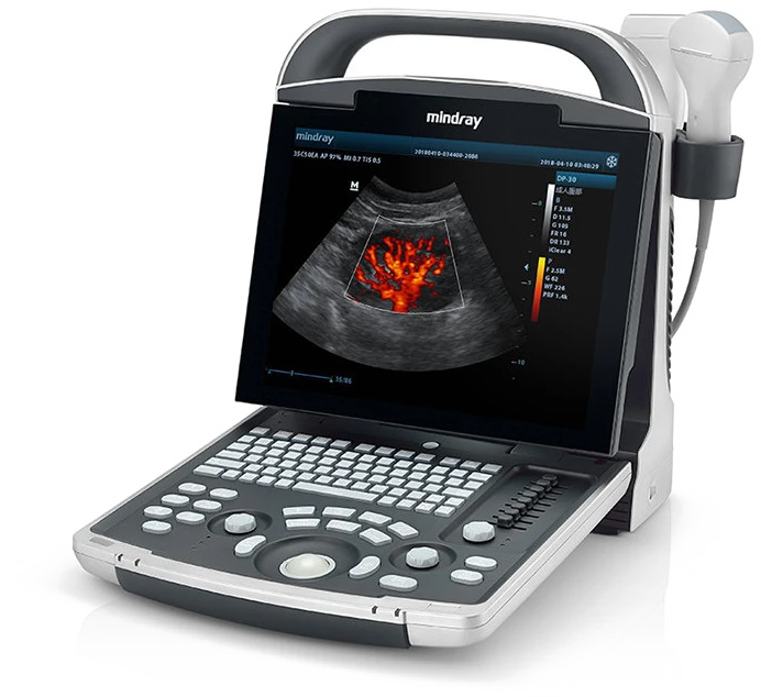 Mindray DP-30