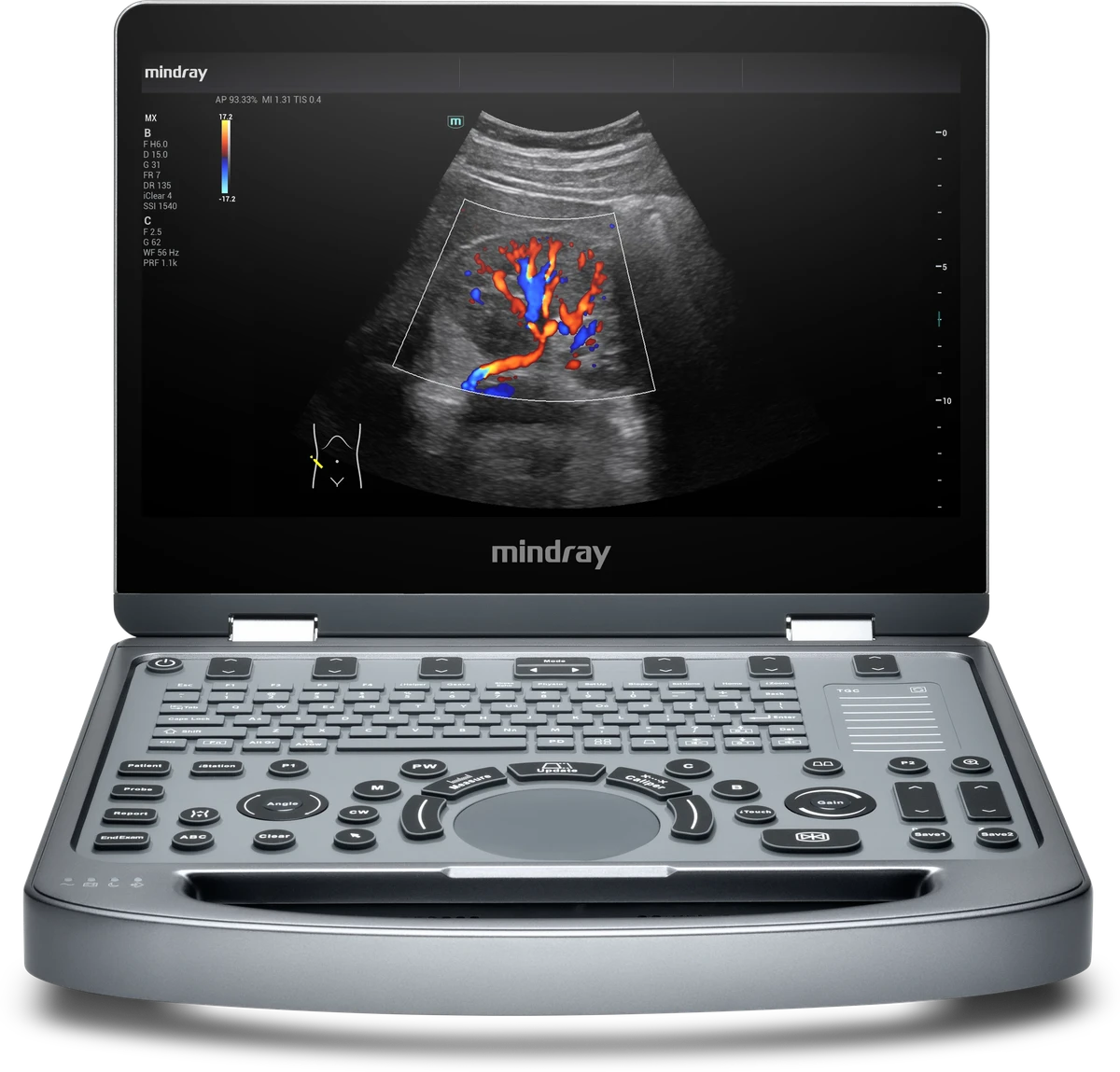 Mindray MX3