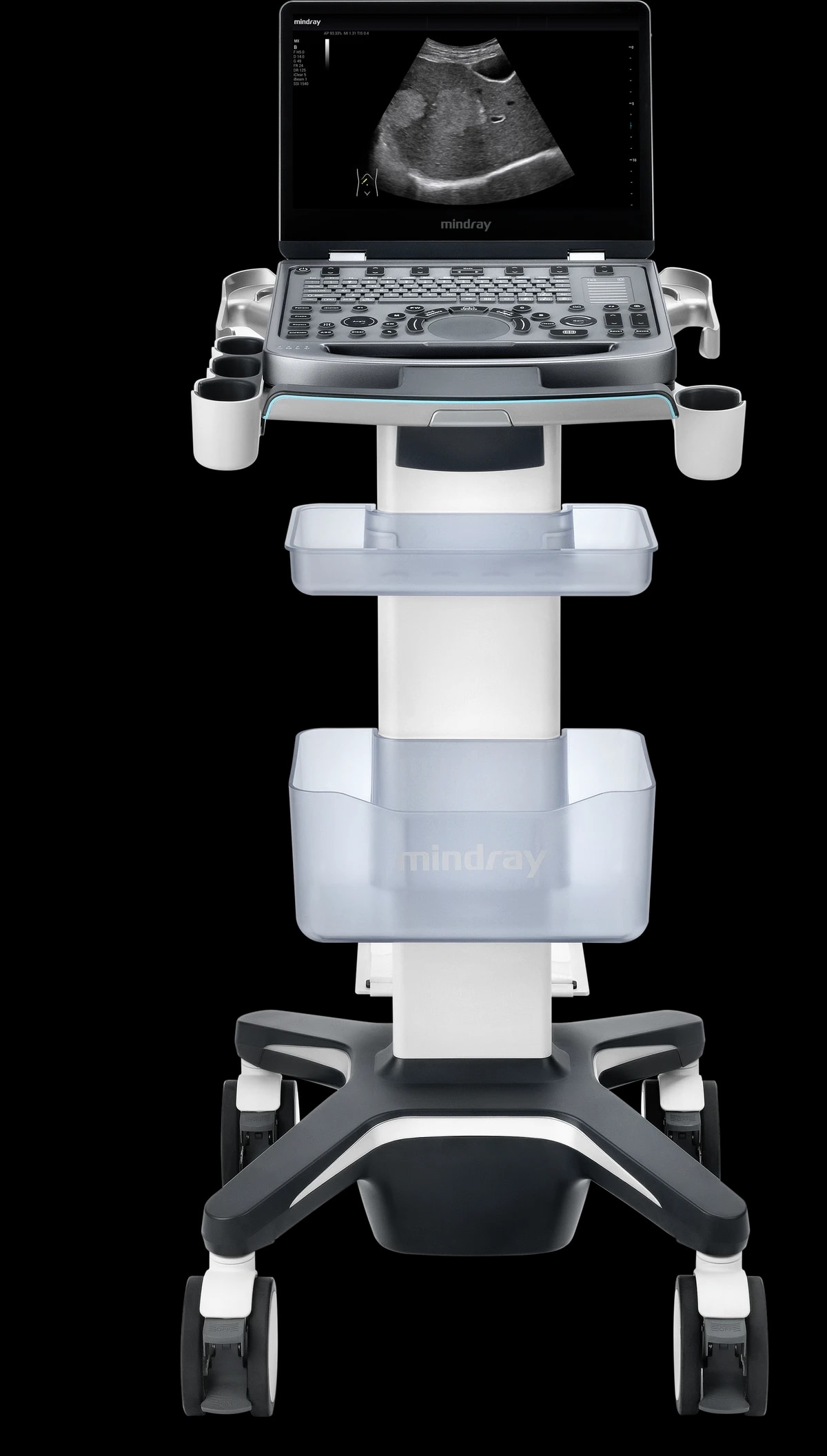 Mindray MX3
