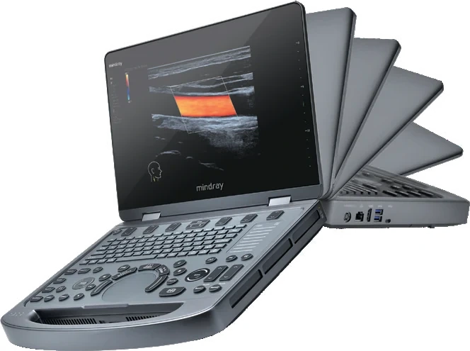 Mindray MX6