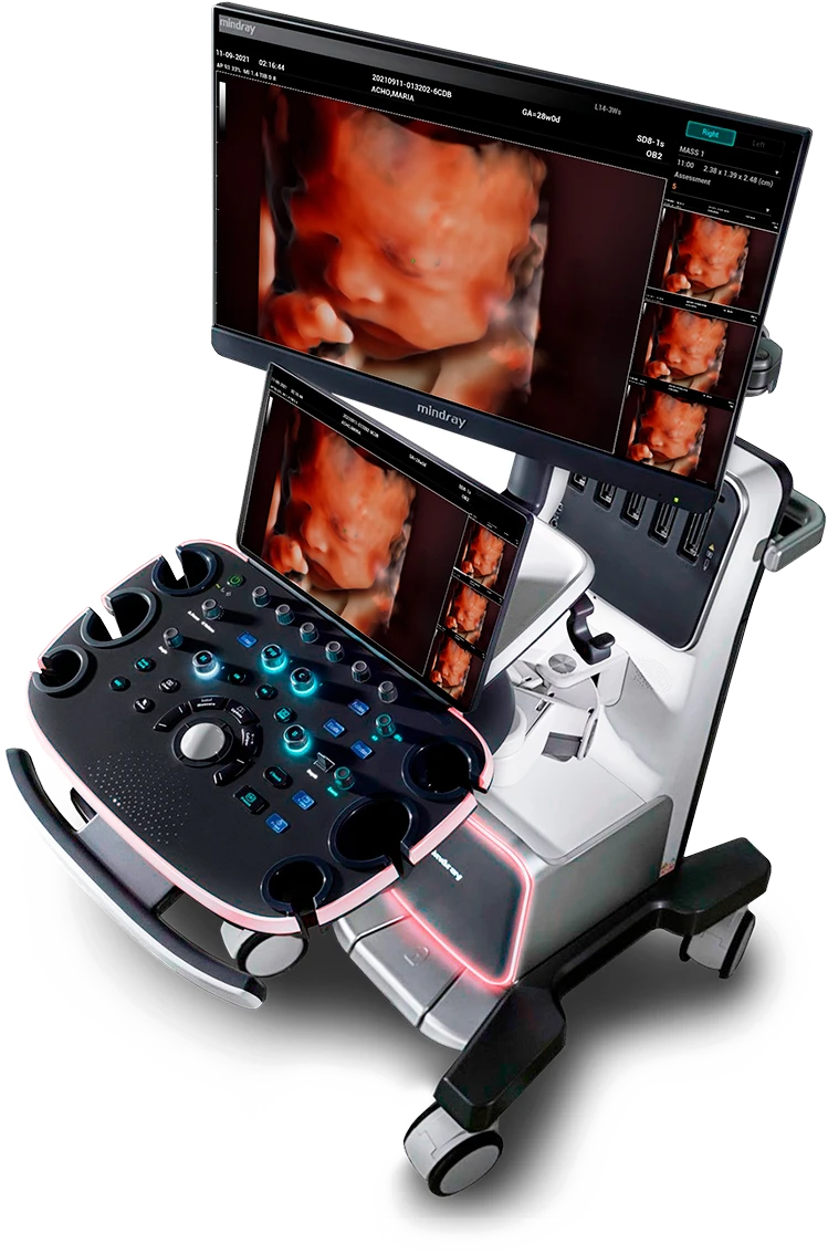 Mindray Nuewa i9