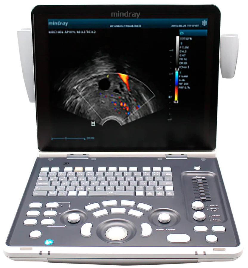 Mindray Z50