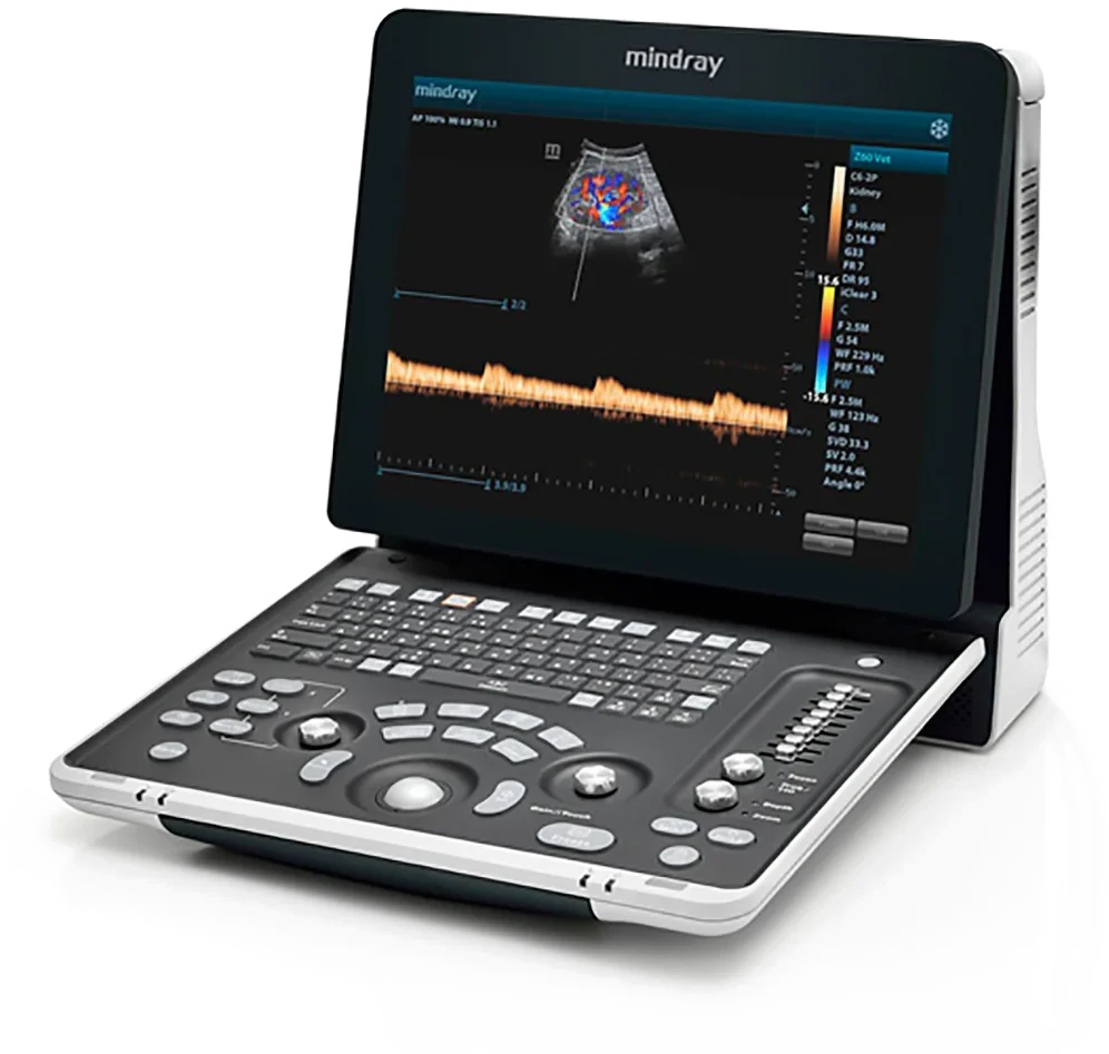 Mindray Z60