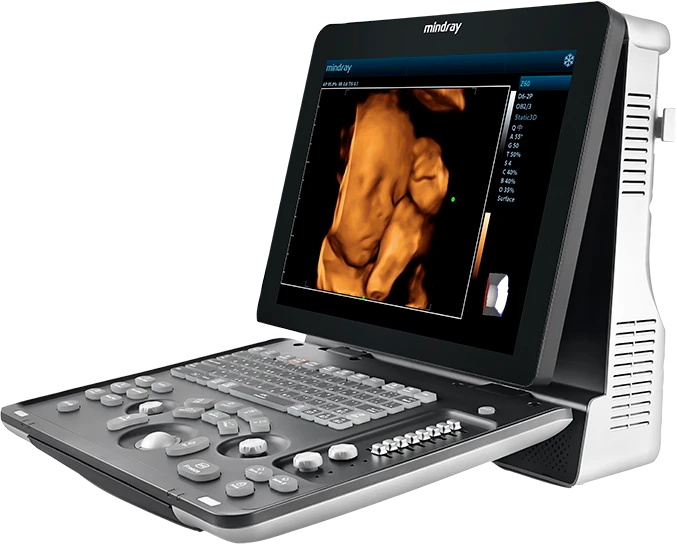 Mindray Z60